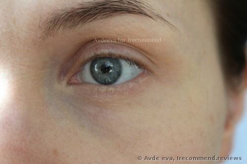 My under eye skin when I applied: an eye cream, hydrating primer, foundation and transparent powder