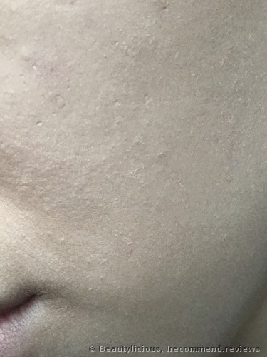 The Ordinary Coverage  Foundation
