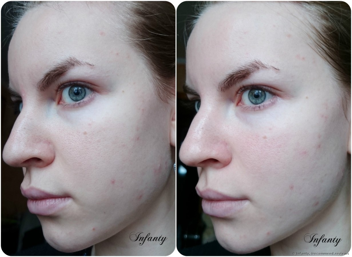 L'oreal Paris PURE-CLAY Exfoliate & Refining Treatment Mask - «Pure Clay Glow Mask with Koalin, Montmorillonite Ghassoul is one more good product from L'oreal. photo and comparison with the other